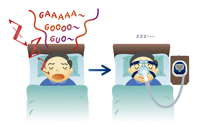 睡眠時無呼吸症候群とは